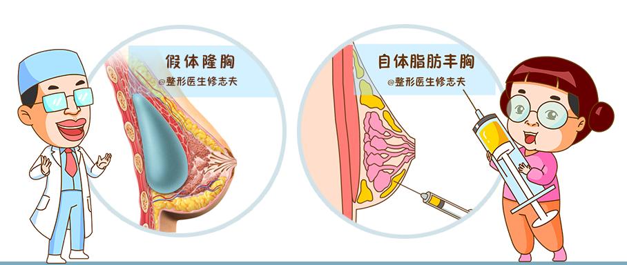 最新款隆胸假體，美麗旅程中的內心平靜探尋