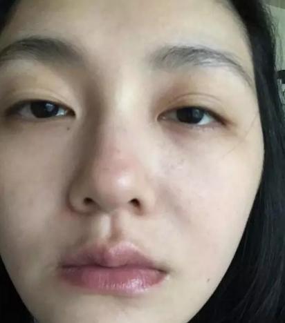 為什么明星不長痘,明星不長痘,背后的故事與真相探尋