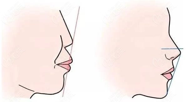 正頜手術(shù)價(jià)格探索，一次尋求內(nèi)心平靜的旅行冒險(xiǎn)