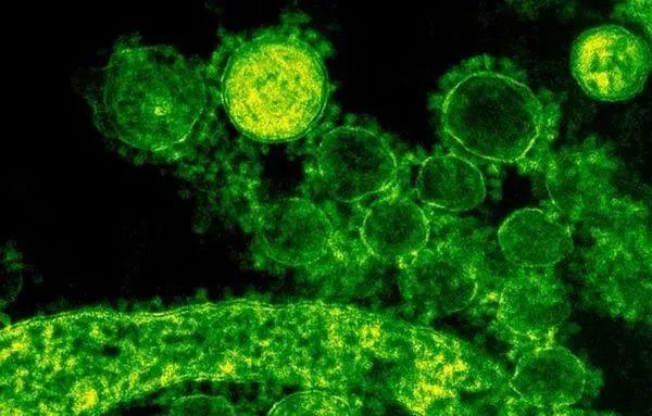 冠狀最新病毒,自然美景中的探索與挑戰(zhàn)