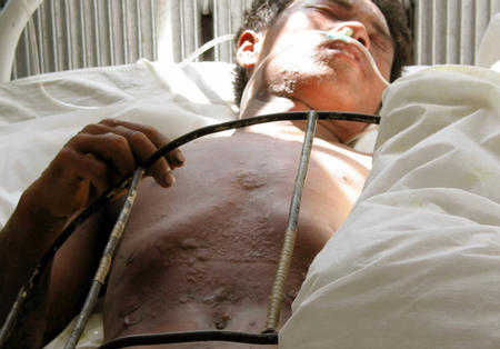 發條毒劑最新動態，學習變化，自信閃耀的旅程